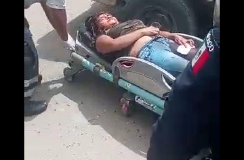 Un hombre y una mujer fueron atacados a balazos en la presa El Chapulín en Xoxocotlán